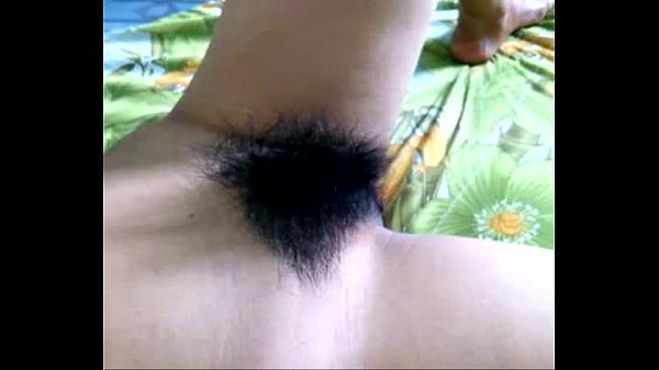 Tạo hình âm đạo